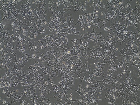 microscope image of Horizon Cas9 stable cells